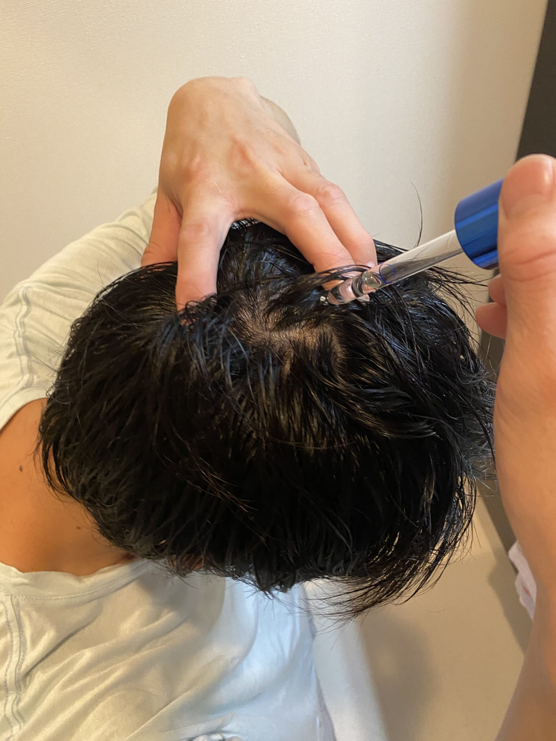 ロレアル 正規品 セリオキシル デンサーヘアnの育毛剤は抜け毛予防 薄毛対策ができるのか 使い方 効果を徹底解説